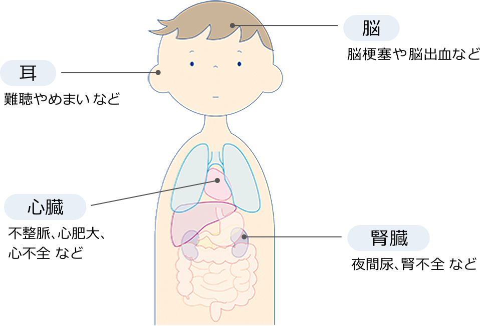 ファブリー病の分類