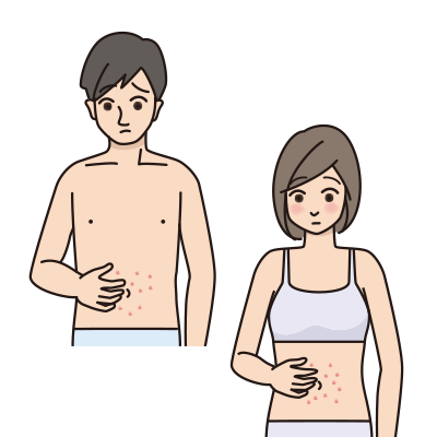 皮膚の赤い発疹（被角血管腫）